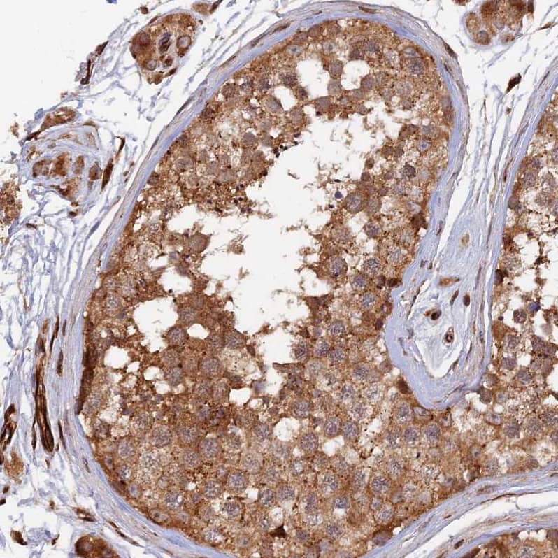 Immunohistochemistry-Paraffin G5pr Antibody - BSA Free