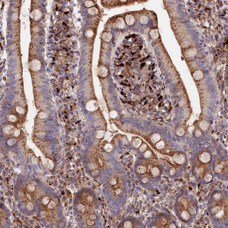 Immunohistochemistry-Paraffin G5pr Antibody - BSA Free