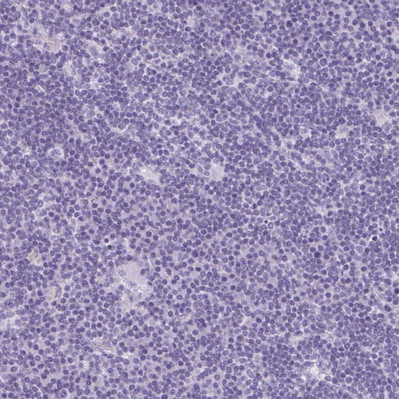 Staining of human lymph node shows no positivity in non-germinal center cells as expected.