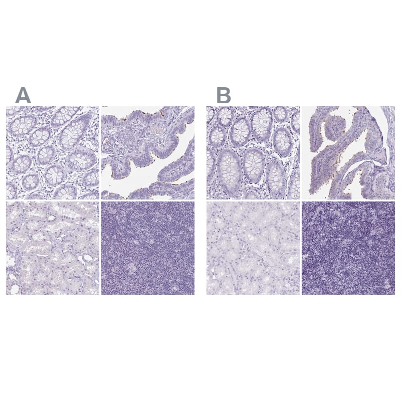 Staining of human colon, fallopian tube, kidney and lymph node using Anti-ENKUR antibody NBP1-89911 (A) shows similar protein distribution across tissues to independent antibody NBP2-34037 (B).