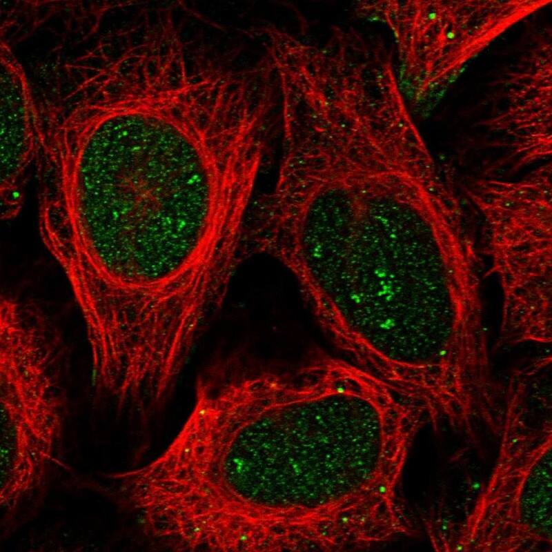 Staining of human cell line U-2 OS shows localization to nucleus, nucleoli fibrillar center & vesicles.