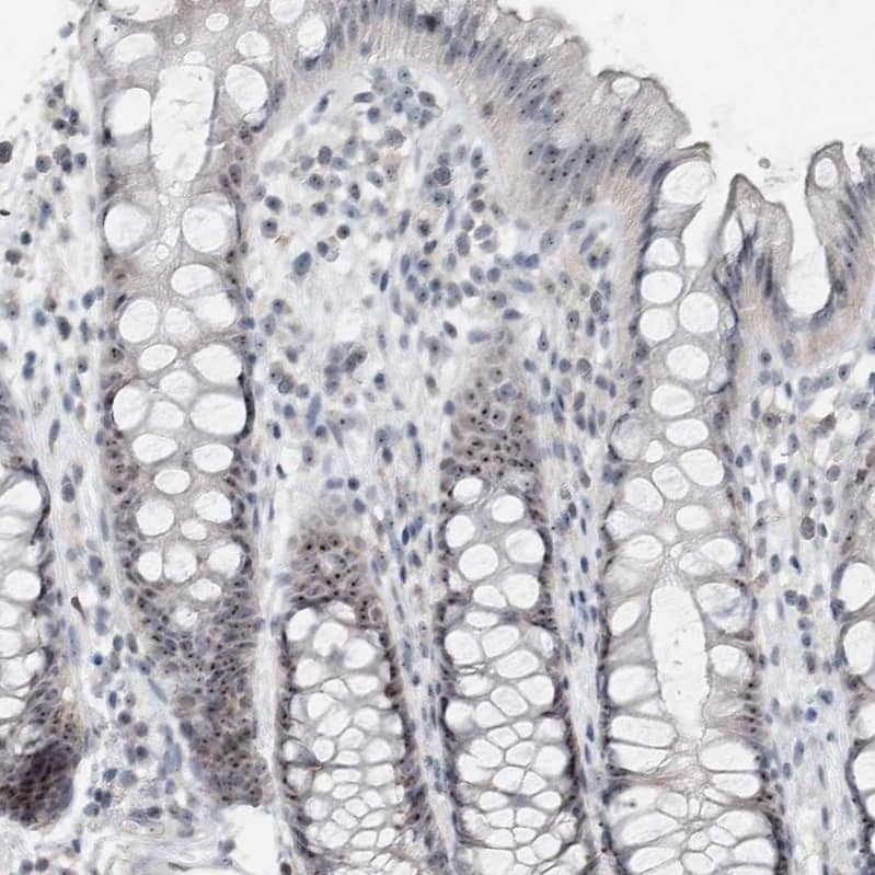 Staining of human rectum shows strong positivity in nucleoli in glandular cells.