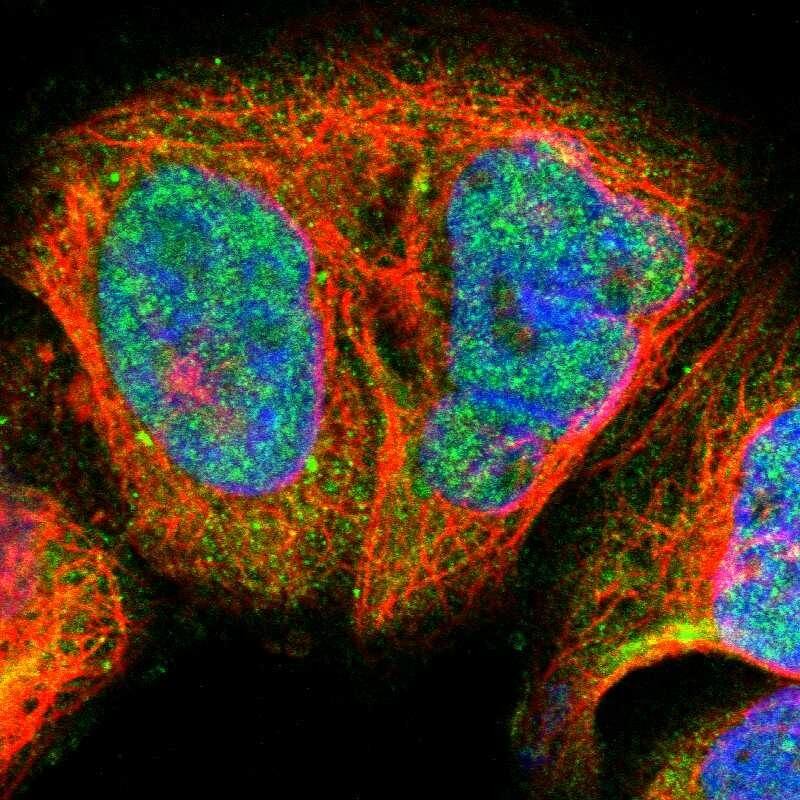 Immunocytochemistry/ Immunofluorescence Blooms Syndrome Protein Blm Antibody - BSA Free