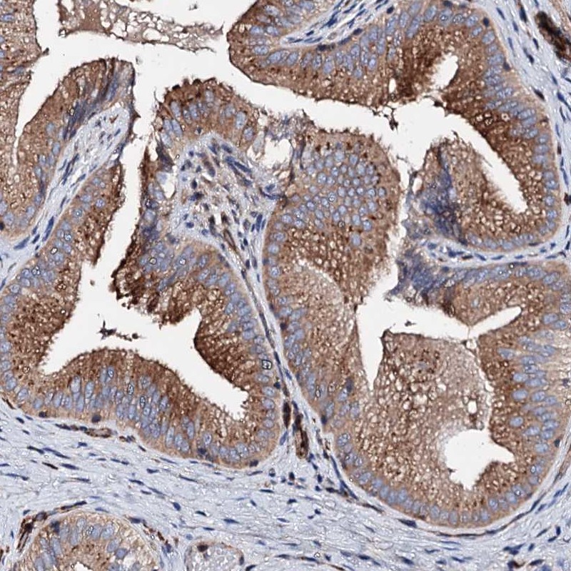 Immunohistochemistry-Paraffin WDR11 Antibody - BSA Free