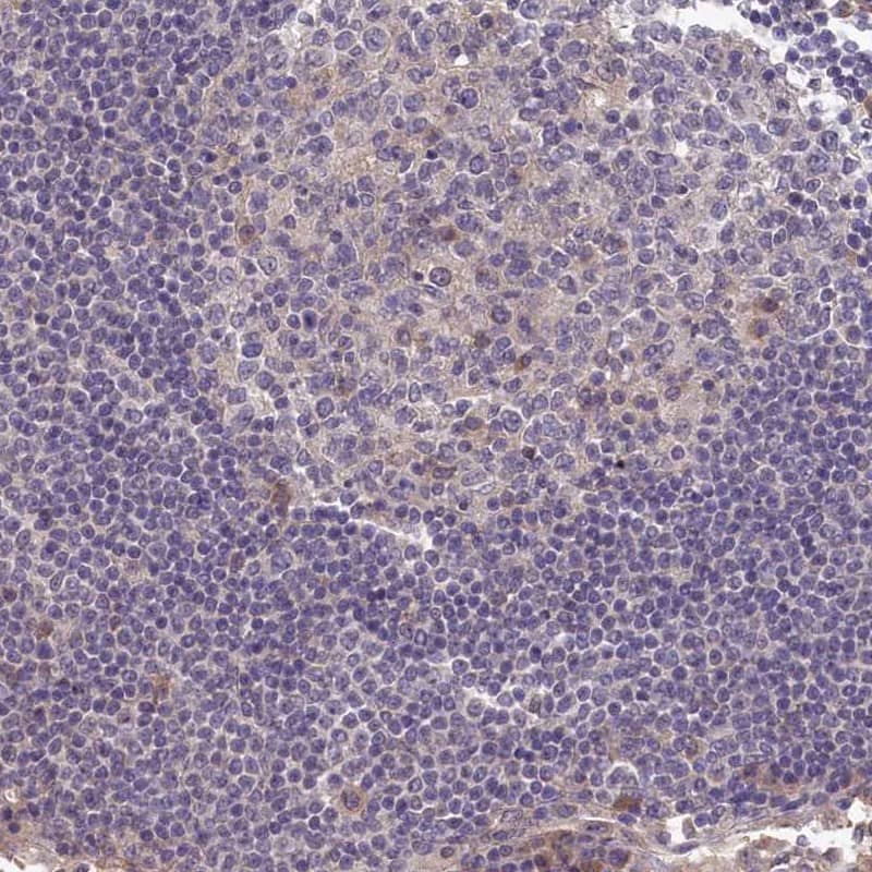 Staining of human lymph node shows low expression as expected.