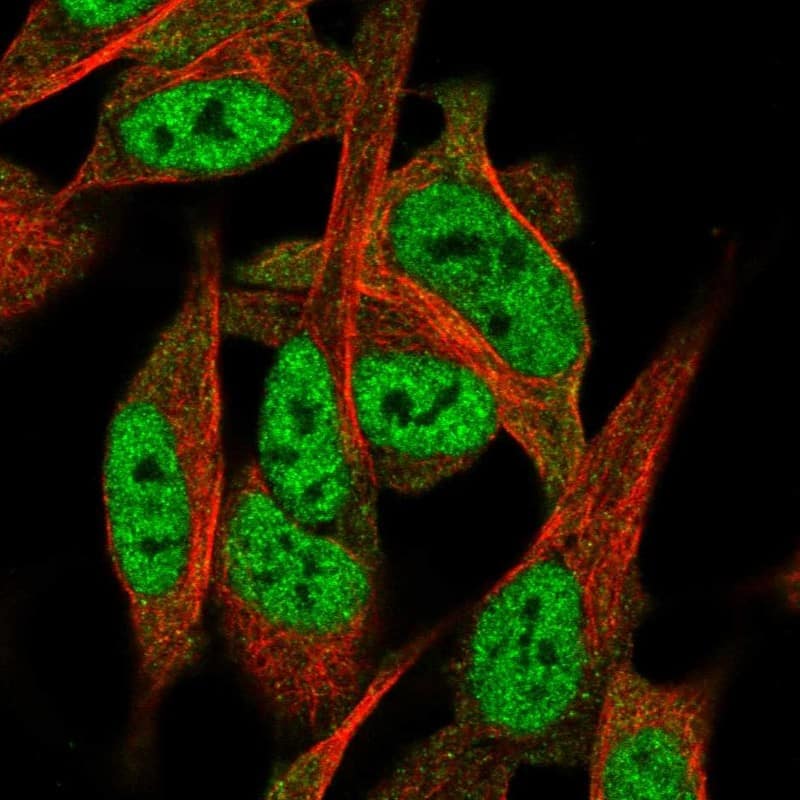 Immunocytochemistry/ Immunofluorescence TNRC4 Antibody - BSA Free