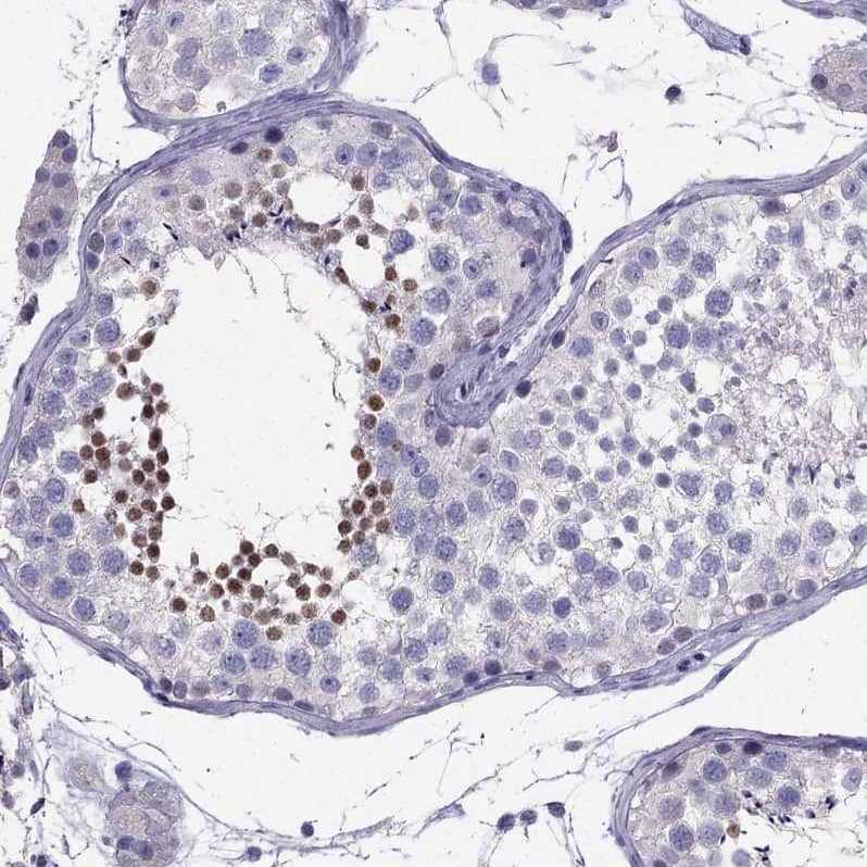 Staining of human testis shows moderate nuclear positivity in cells in seminiferous ducts.