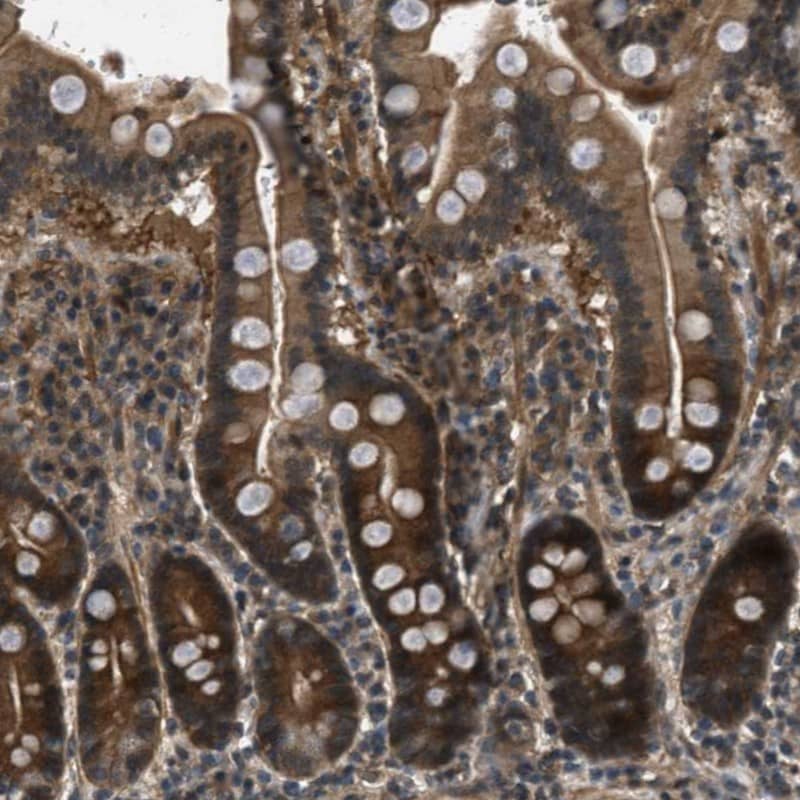 Immunohistochemistry-Paraffin Epithelial Stromal Interaction 1 Antibody - BSA Free