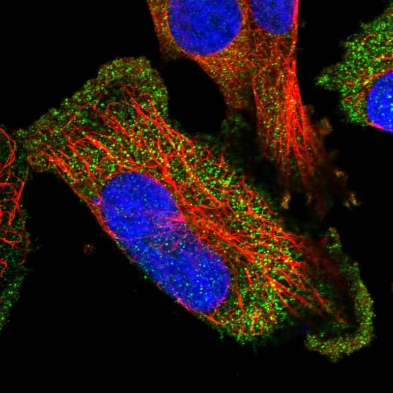 Staining of human cell line U-251 MG shows localization to cytosol.