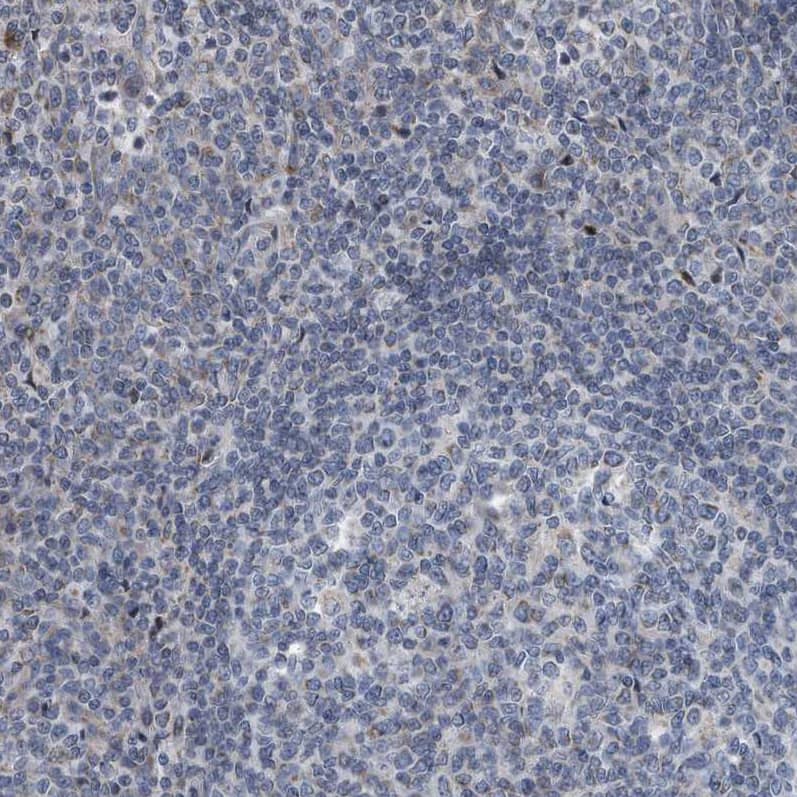 Immunohistochemistry-Paraffin Dystonin Antibody - BSA Free