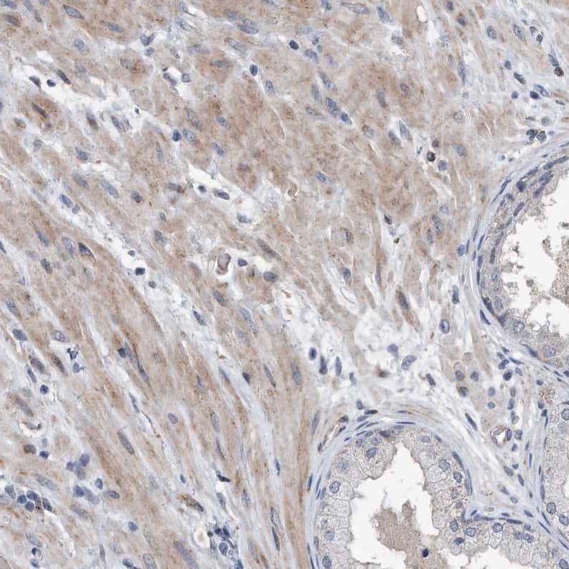 Staining of human prostate shows weak to moderate cytoplasmic positivity in smooth muscle cells.
