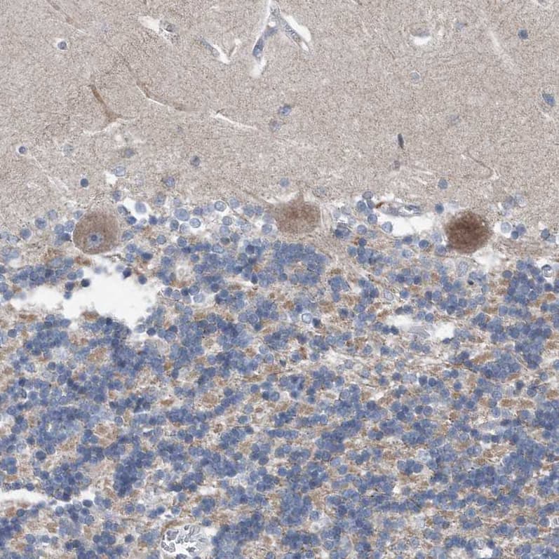 Staining of human cerebellum shows weak to moderate cytoplasmic positivity in Purkinje cells.