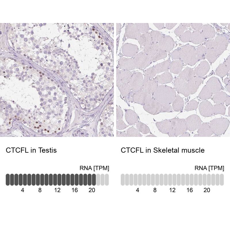 Analysis in human testis and skeletal muscle tissues using NBP1-89947 antibody. Corresponding CTCFL RNA-seq data are presented for the same tissues.