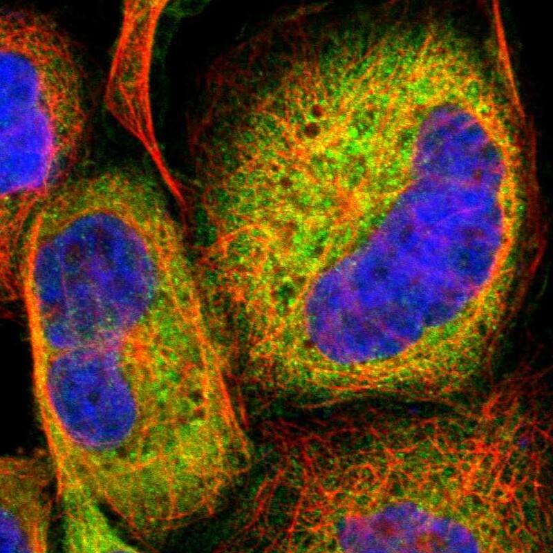 Staining of human cell line A-431 shows localization to endoplasmic reticulum.