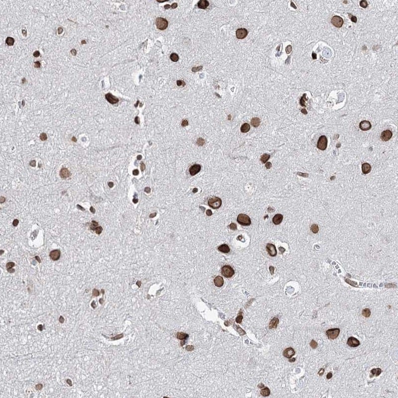 Staining of human cerebral cortex shows strong nuclear membrane positivity in neuronal cells.
