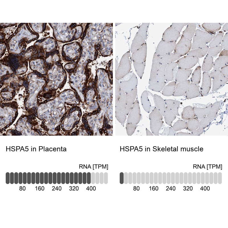 <b>Orthogonal Strategies Validation. </b>Analysis in human placenta and skeletal muscle tissues. Corresponding RNA-seq data are presented for the same tissues.
