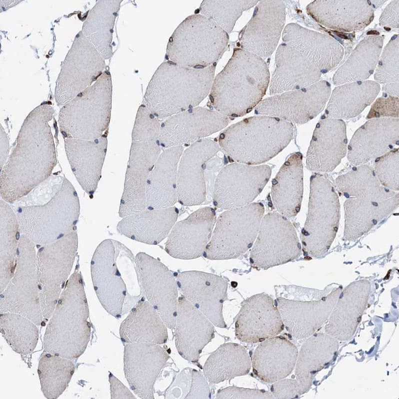 Staining of human skeletal muscle shows no positivity in striated muscle fibers as expected.