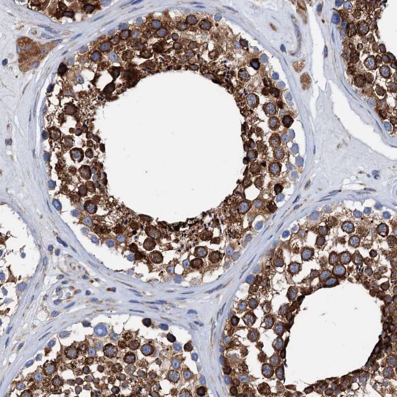 Staining of human testis shows strong cytoplasmic positivity in cells in seminiferous ducts.