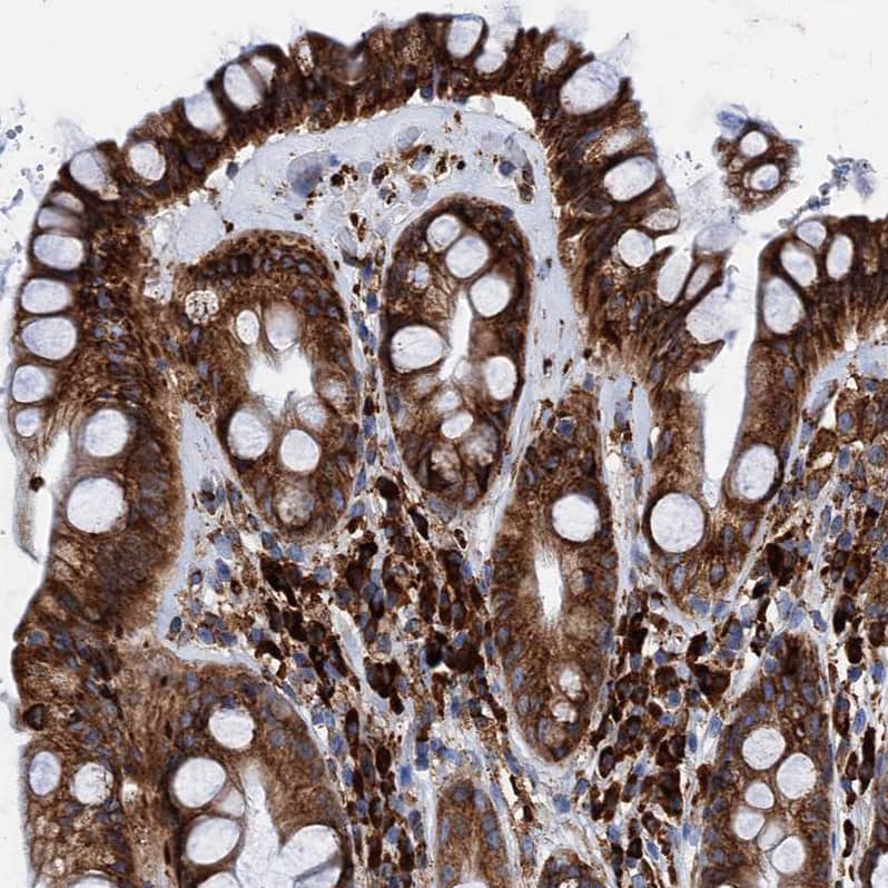 Staining of human rectum shows strong cytoplasmic positivity in glandular and lymphoid cells.