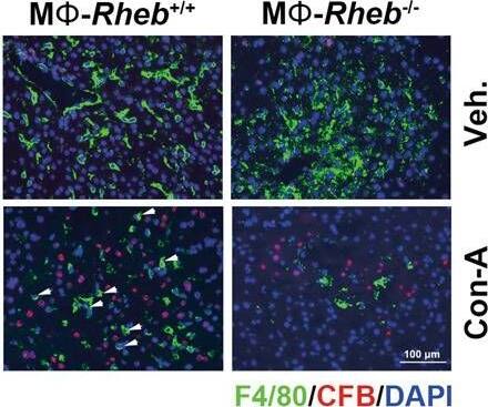 The activation of mTORC1 in KCs enhances complement alternative system.a Expression heatmap of genes of neutrophils chemotaxis or complement activation analyzed by RNA-seq from Tsc1+/+ and Tsc1-/- BMMs (n = 3 each). b Western blotting result was shown the expression of CFB protein in hepatic tissues from mice. c Left, representative co-immunofluorescent staining images for F4/80 with CFB. Scale bar = 50 μm. Right, quantitative determination of F4/80+ and CFB+ cells among groups as indicated, n = 3. d Western blotting assay showing the abundance for TSC1, CFB, and p-S6 in BMMs. e qRT-PCR analysis showing the CFB mRNA abundance in BMMs, n = 3. f Western blotting assay showing the abundance for TSC1, CFB, and p-S6 in KCs. g qRT-PCR analysis showing the CFB mRNA abundance in KCs, n = 3. h Representative immunofluorescent staining images for C3d. Scale bar = 50 μm. i Representative immunostaining images for C5b-9. Scale bar = 50 μm. j Western blotting assay showing the abundance for Rheb and CFB in BMMs. k Western blotting assay showing the abundance for Rheb and CFB in KCs. l Representative co-immunofluorescent staining images for F4/80 with CFB (white arrows). Scale bar = 100 μm. m Quantitative determination of F4/80+ and CFB+ cells among groups as indicated, n = 3. n Representative immunofluorescent staining images for C3d. Scale bar = 100 μm. o Representative immunostaining images for C5b-9 among groups as indicated. Scale bar = 100 μm. *p < 0.05. Image collected and cropped by CiteAb from the following open publication (//pubmed.ncbi.nlm.nih.gov/36494334), licensed under a CC-BY license. Not internally tested by Novus Biologicals.