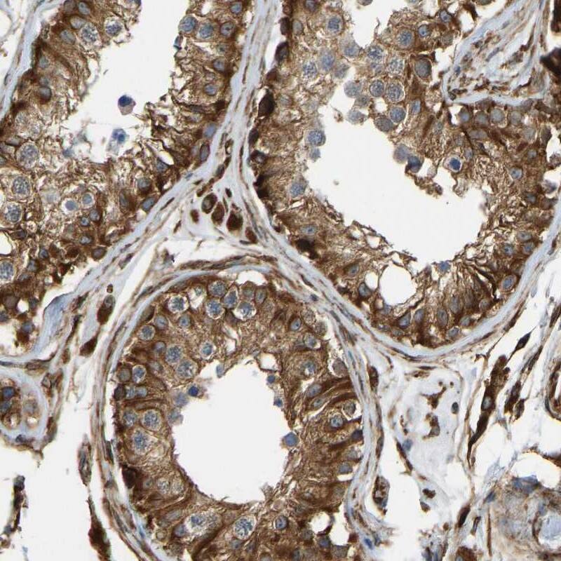 Staining of human testis shows strong cytoplasmic positivity in cells in seminiferus tubules and leydig cells.