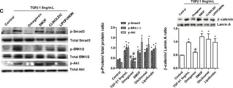 Omegaven® inhibits epithelial to mesenchymal transition induced by TGF beta 1.Human liver epithelial cell line THLE-3 was incubated in presence or absence of lipid emulsions Omegaven® 10%, Lipofundin MCT/LCT® 20%, ClinOleic® 20% or SMOFlipid® 20% at different dilutions, for 30 min followed by TGF beta 1 5 ng/mL stimulation for additional 72 hours (A and B) or 25 min (C). (A) Expression of mRNA of ZO-1 and (B) E-cadherin. (C) Phosphorylation of Samd3, ERK1/2 and Akt and nuclear expression of  beta -catenin. Representative western blot are showed and quantified in graphic bars. Results are expressed as means +/- SEM of six independent experiments. *p<0.05 related to the control group. #p<0.05 related to the stimulus. Image collected and cropped by CiteAb from the following open publication (//pubmed.ncbi.nlm.nih.gov/25502575), licensed under a CC-BY license. Not internally tested by Novus Biologicals.