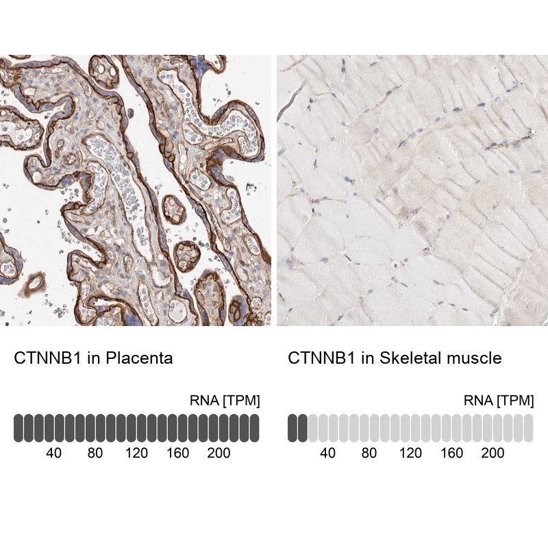 <b>Orthogonal Strategies Validation. </b>Analysis in human placenta and skeletal muscle tissues using Anti-CTNNB1 antibody. Corresponding CTNNB1 RNA-seq data are presented for the same tissues.