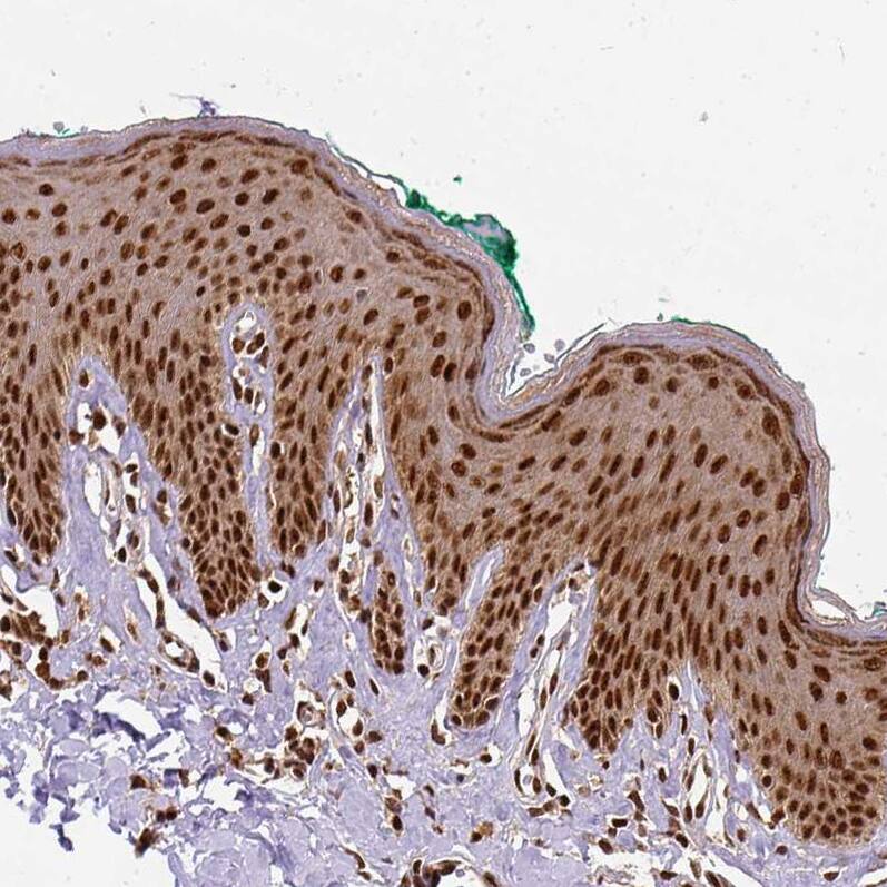 Staining of human skin shows strong cytoplasmic-nuclear positivity in squamous epithelial cells.