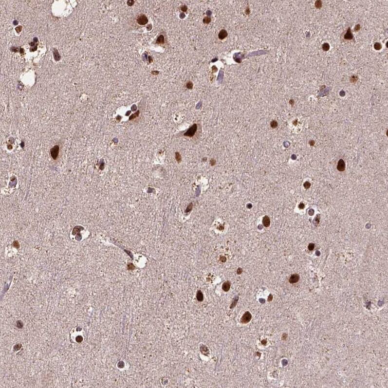 Staining of human cerebral cortex shows strong nuclear positivity in neurons.