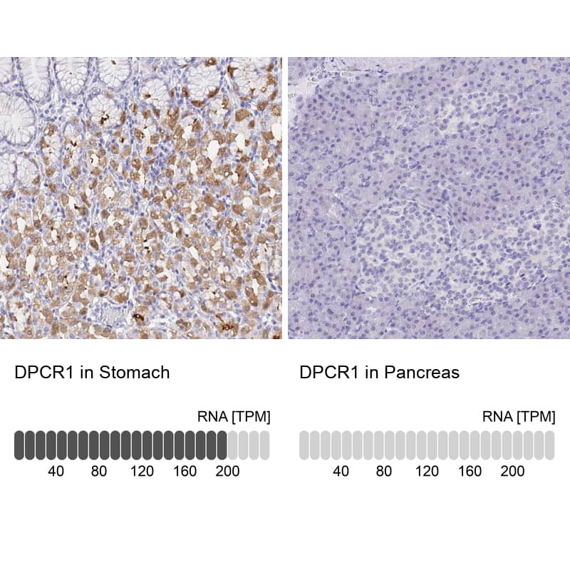 Analysis in human stomach and pancreas tissues using Anti-DPCR1 antibody. Corresponding DPCR1 RNA-seq data are presented for the same tissues.