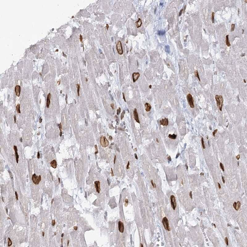 Staining of human heart muscle shows strong nuclear membrane positivity in myocytes.
