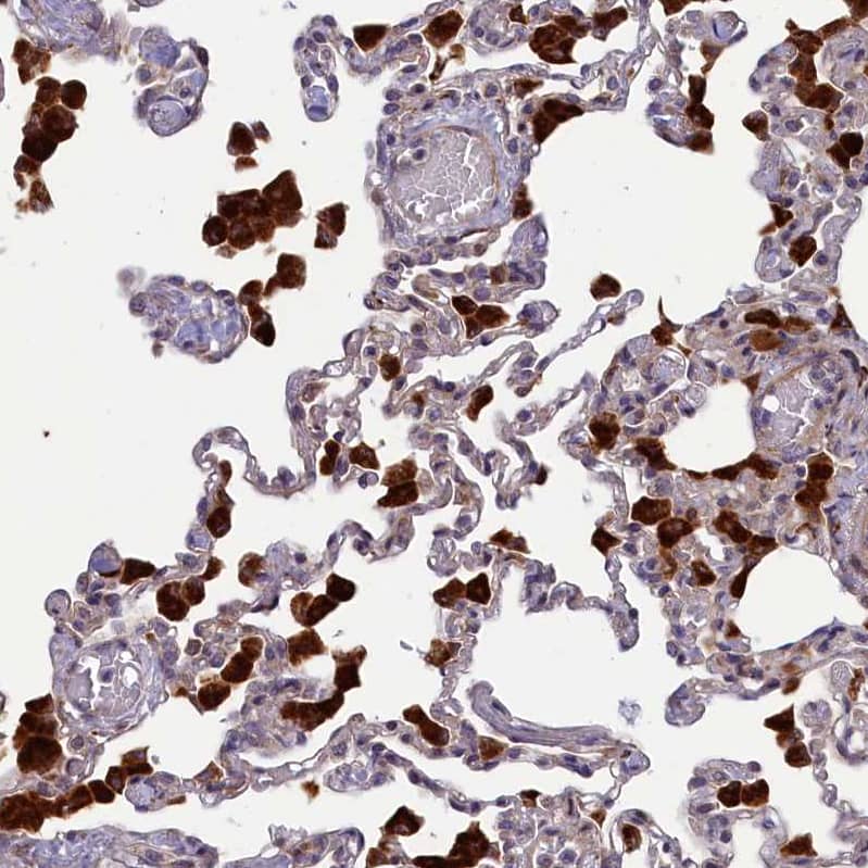 Staining of human lung shows strong cytoplasmic positivity in macrophages.