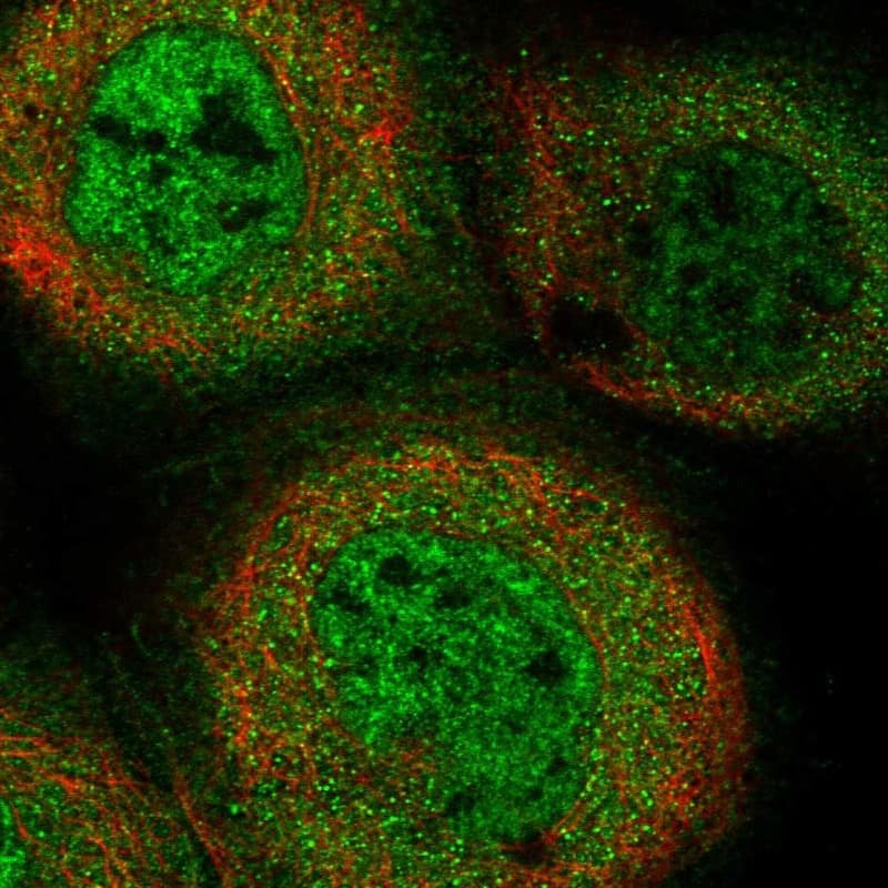 Staining of human cell line A-431 shows localization to nuclear speckles & cytosol.
