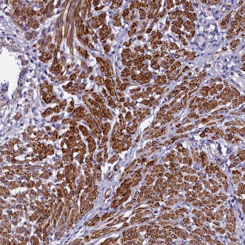 Immunohistochemistry-Paraffin Bcl rambo Antibody - BSA Free