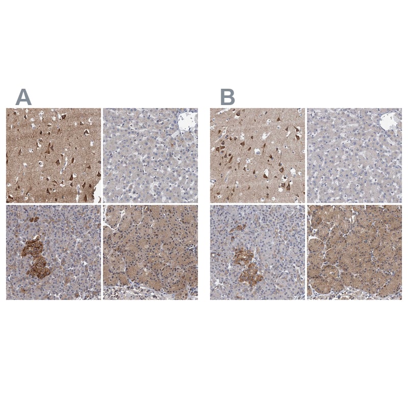 <b>Orthogonal Strategies Validation. </b>Staining of human cerebral cortex, liver, pancreas and stomach HPA040385 (A) shows similar protein distribution across tissues to independent antibody HPA039730 (B).