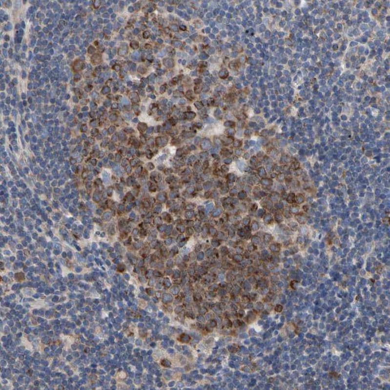 Staining of human lymph node shows moderate cytoplasmic positivity in germinal center cells.