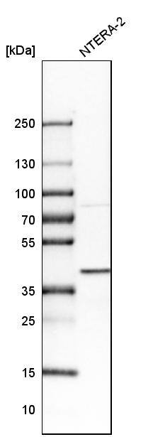 Analysis in human cell line NTERA-2.
