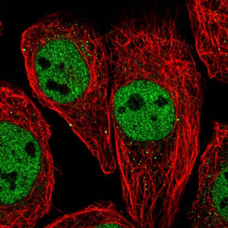 Staining of human cell line A-431 shows localization to nucleoplasm & vesicles.