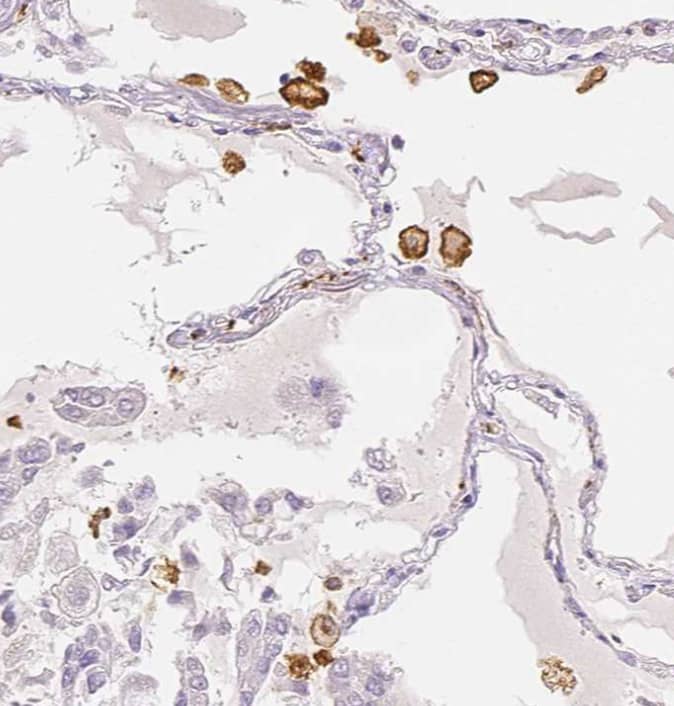 Immunohistochemistry-Paraffin MMR/CD206/Mannose Receptor Antibody - BSA Free