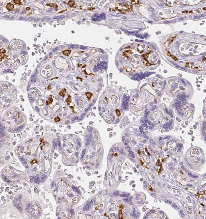 Immunohistochemistry-Paraffin MMR/CD206/Mannose Receptor Antibody - BSA Free