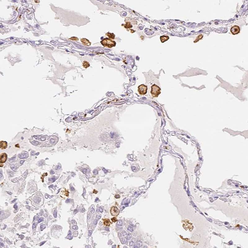 Immunohistochemistry-Paraffin MMR/CD206/Mannose Receptor Antibody - BSA Free