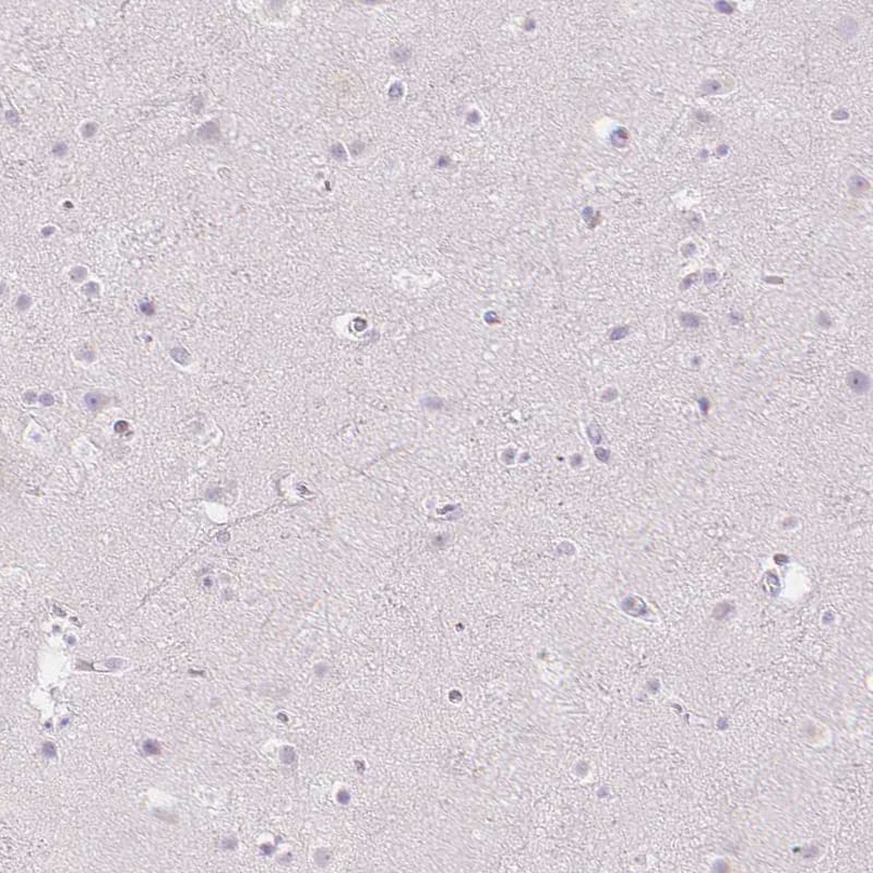 Immunohistochemistry-Paraffin MMR/CD206/Mannose Receptor Antibody - BSA Free