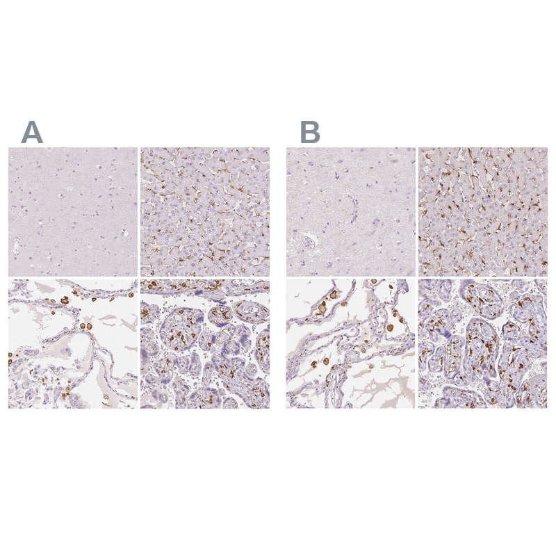 Immunohistochemistry-Paraffin MMR/CD206/Mannose Receptor Antibody - BSA Free
