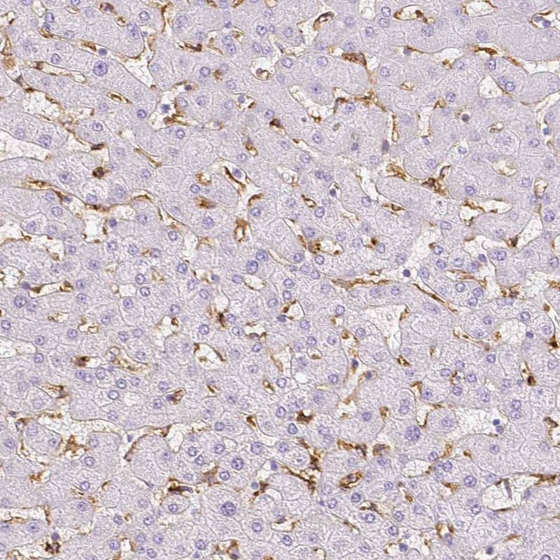 Immunohistochemistry-Paraffin MMR/CD206/Mannose Receptor Antibody - BSA Free