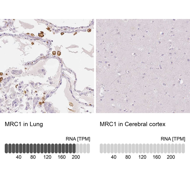 Immunohistochemistry-Paraffin MMR/CD206/Mannose Receptor Antibody - BSA Free