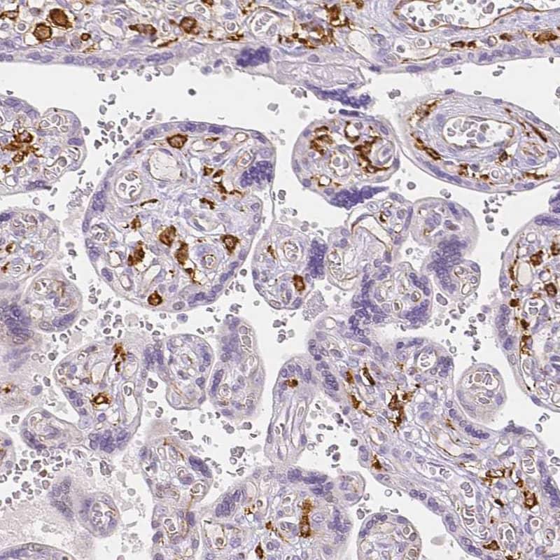 Immunohistochemistry-Paraffin MMR/CD206/Mannose Receptor Antibody - BSA Free