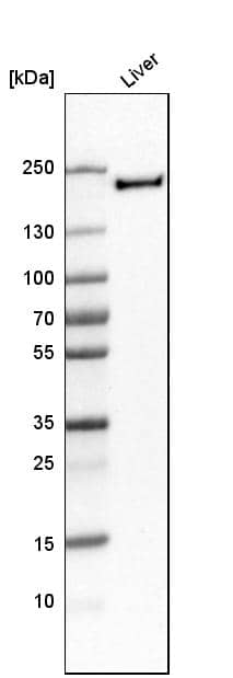 Western Blot MMR/CD206/Mannose Receptor Antibody - BSA Free