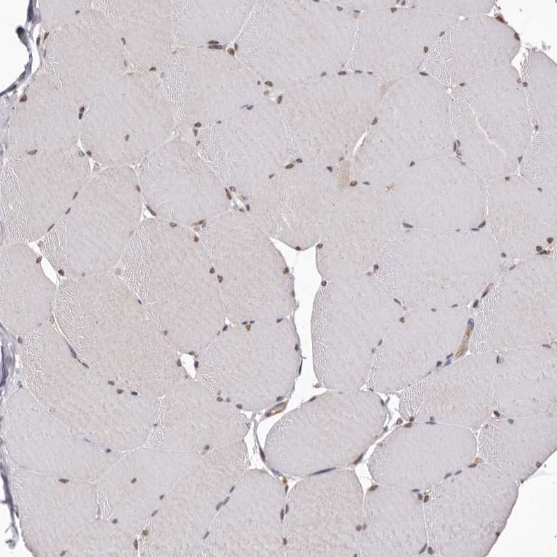 Staining of human skeletal muscle shows no cytoplasmic positivity in myocytes as expected.