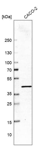 Analysis in human cell line CACO-2.