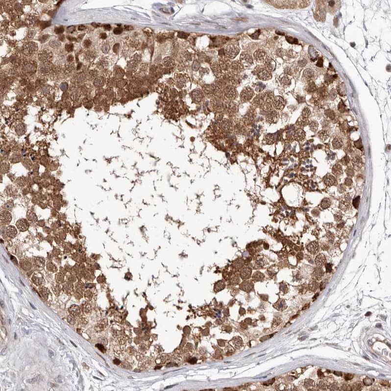 Staining of human testis shows strong nuclear and cytoplasmic positivity in cells in seminiferous ducts.